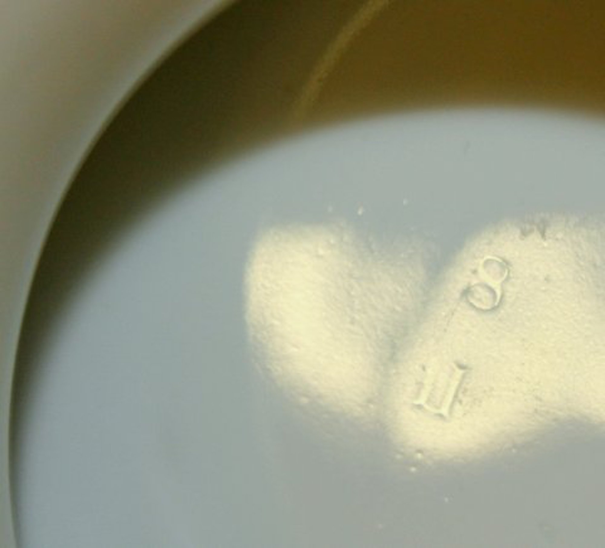 Antique Continental Hand-painted Porcelain Botanical Soup Tureen - Image 3